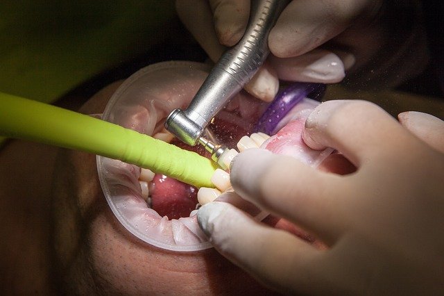 Limpeza, higiene bucal e clareamento dental