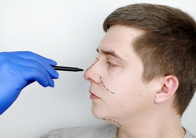 A cirurgia plástica de nariz: como é feita?