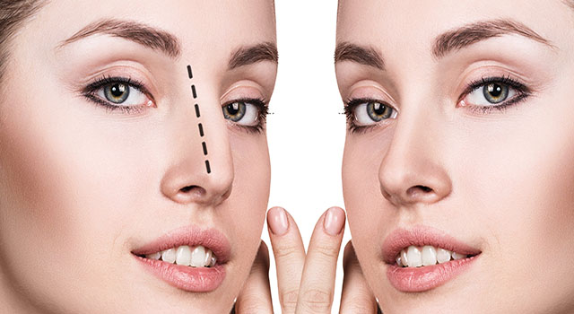 Entenda a diferença entre rinoplastia estética e funcional