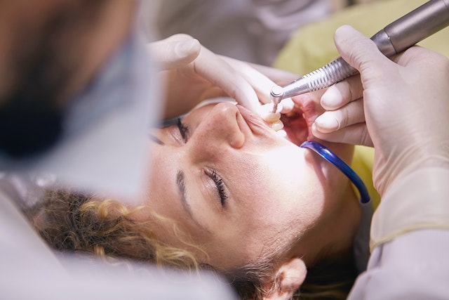 Quando a limpeza dentária é necessária?